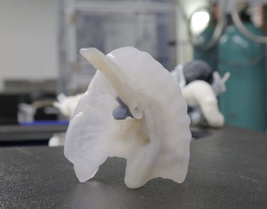 3D Printing Medical Model